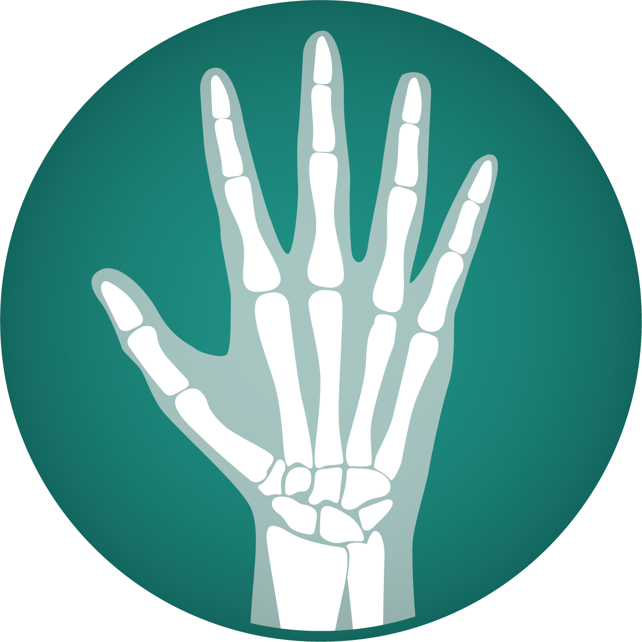 Hand Surgery
